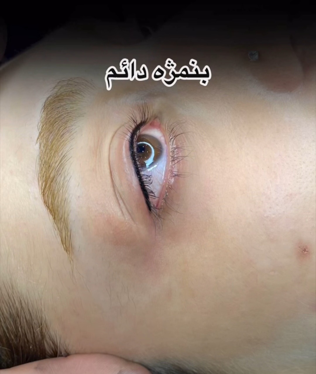 میکرو مهدیه