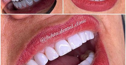 کلینیک دندانپزشکی بهتا