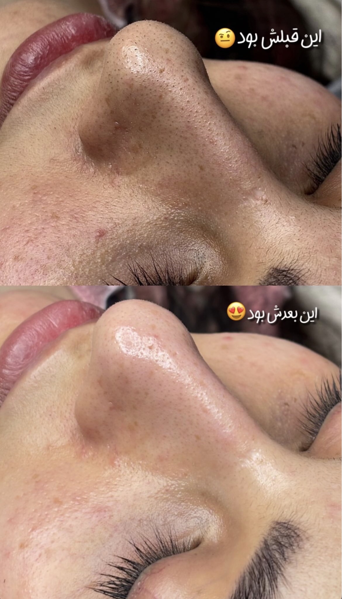 فیشال تخصصی پوست هلیا