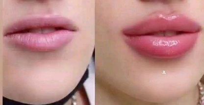 کلینیک پوست مو زیبایی و لیرز نیاوران