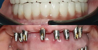 دکتر احسان هاشمی - متخصص پروتزهای دندانی، ایمپلنت و زیبایی