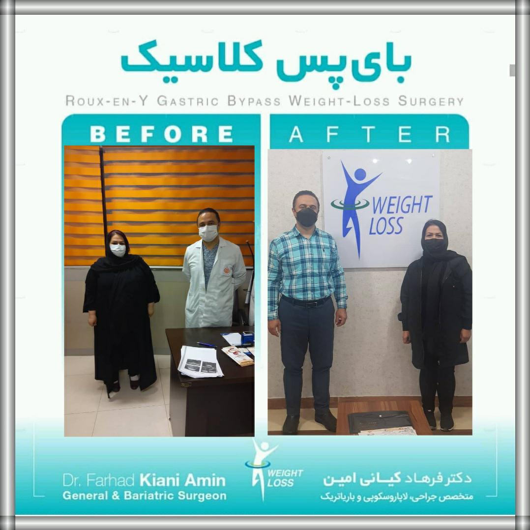 مطب اسلیوکرج