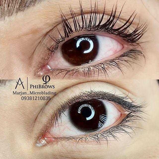 میکروبلیدینگ مرجان