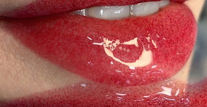 مرکز تخصصی میکروبلیدینگ  اسکالپ سر صوفیا