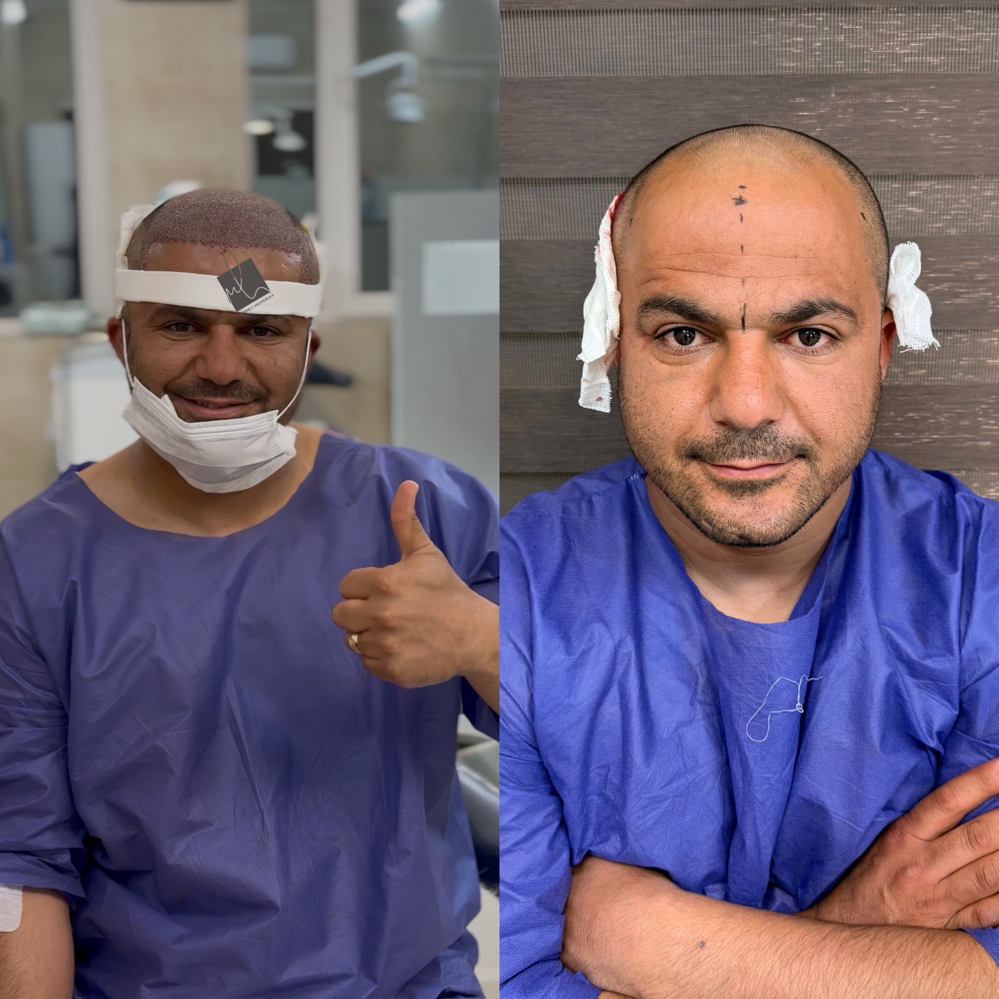 کاشت تخصصی مو،ابرو و ریش هاشمیان