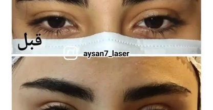 مرکز زیبایی و لیزر آیسان ۷