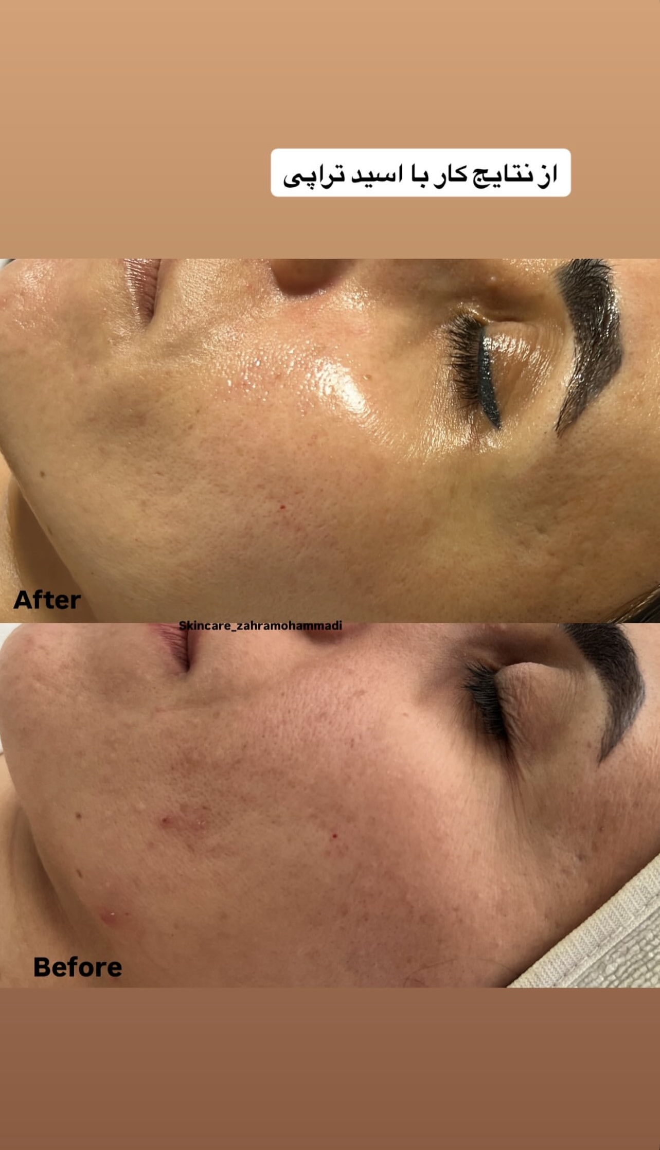 کلینیک فیشال و ماساژ سارن اسکین سارا