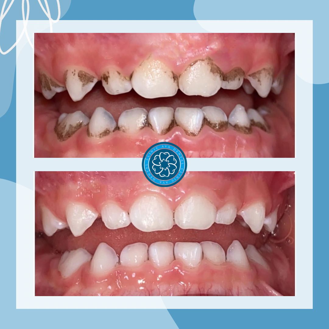 کلینیک دندانپزشکی آوا (اقساط)