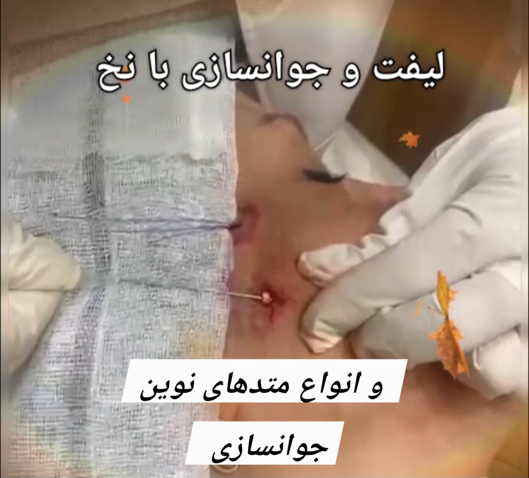 ناهید سلیمان پور
