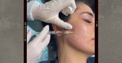 کلینیک زیبایی اویسا پوست،مو،زیبایی  لیزر