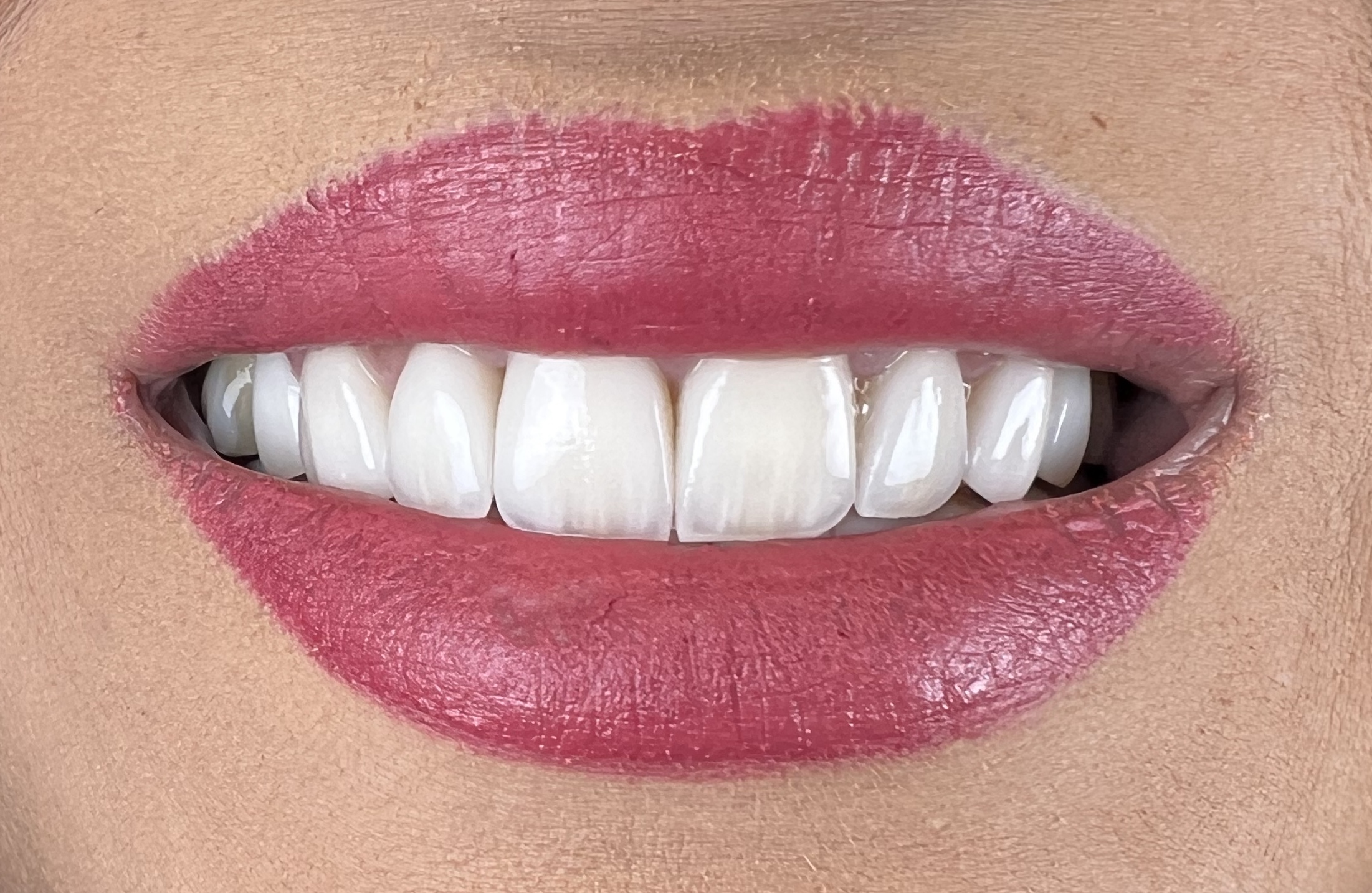 دکتر کیارش مهدی پور جراحی لثه و ایمپلنت