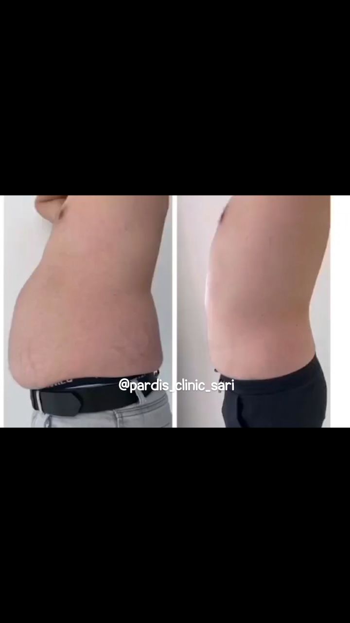 کلینیک لاغری پردیس