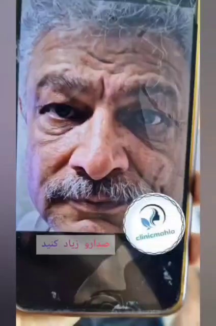 مرکز لیزر و کلینیک زیبایی مهلا