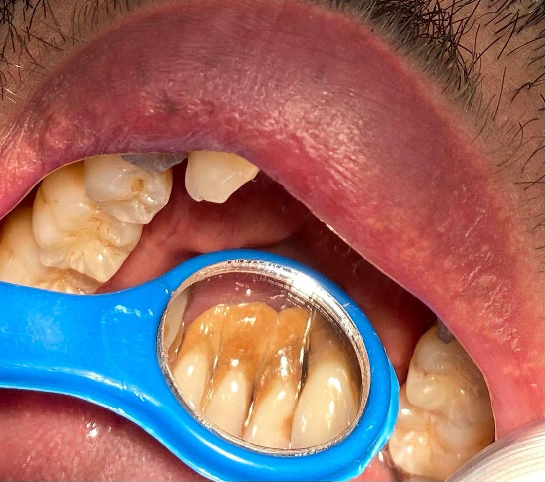 دندانپزشکی دکتر فاطمه محبوبی