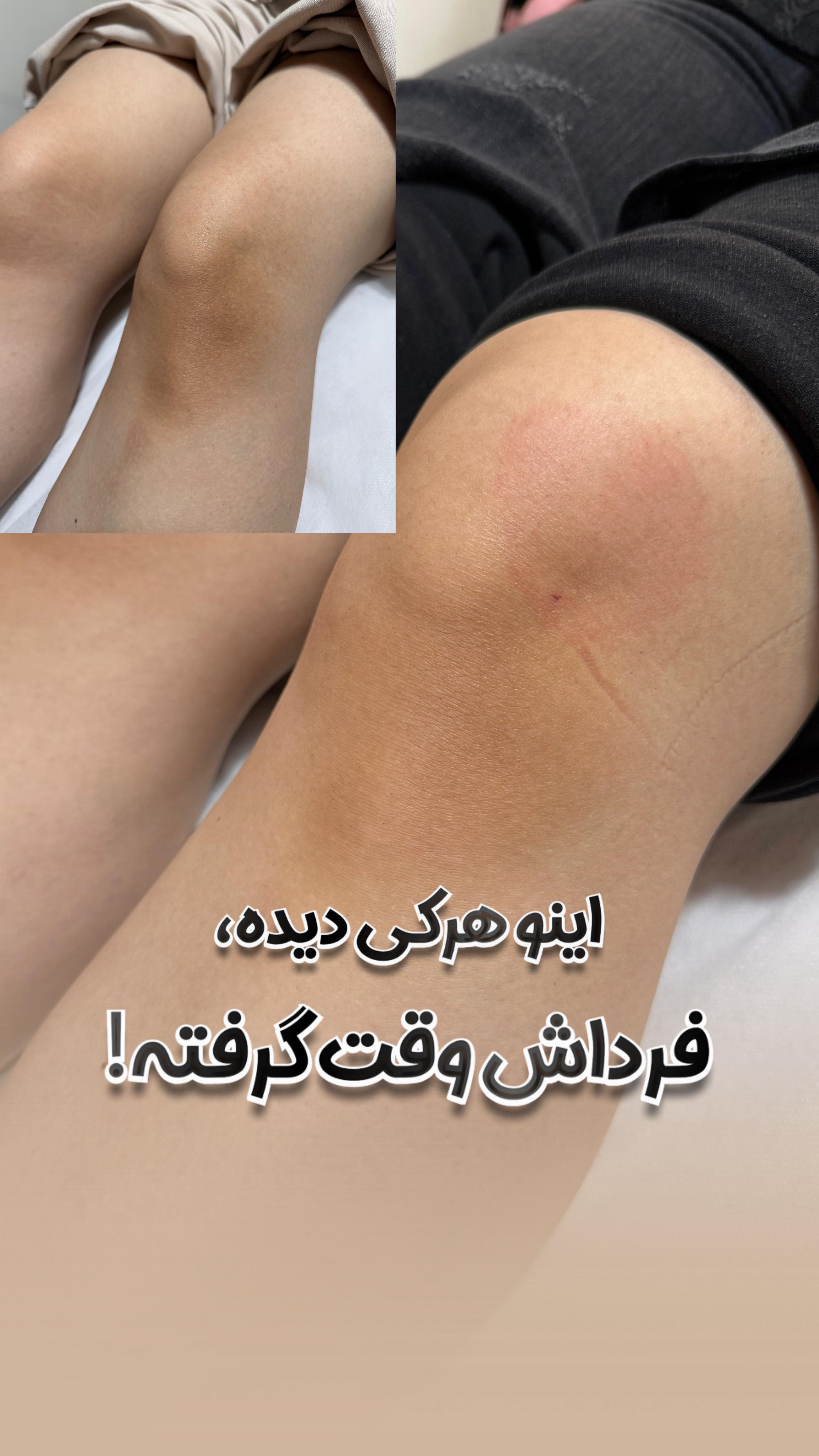 مرکز پوست و لیزر بلزا