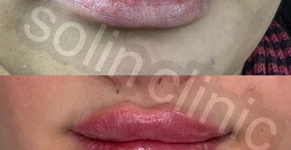 کلینیک زیبایی و لیزر سولین