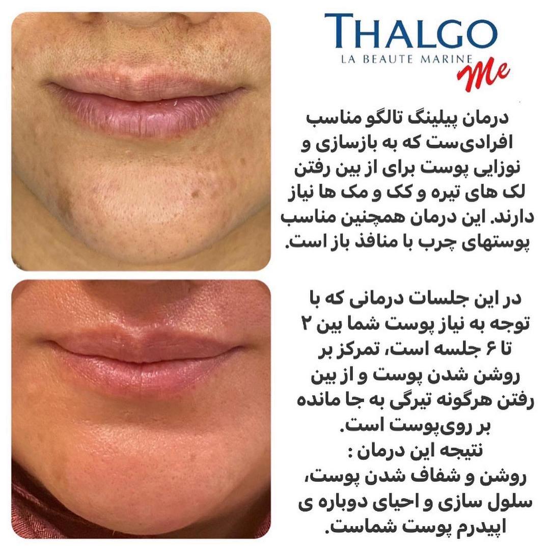 مرکز تخصصی پوست تالگو - تالگومی