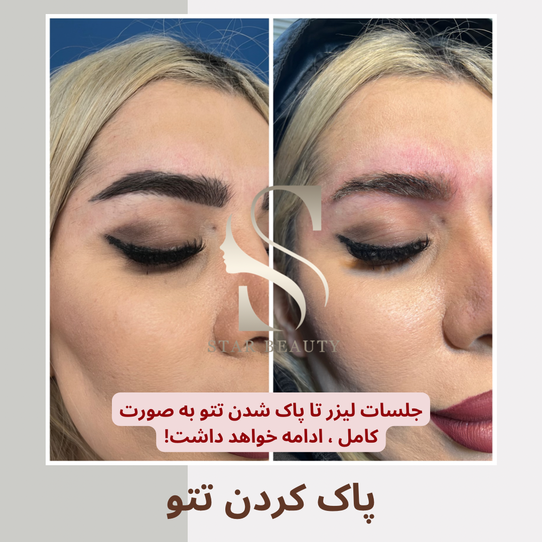 کلینیک زیبایی استاربیوتی