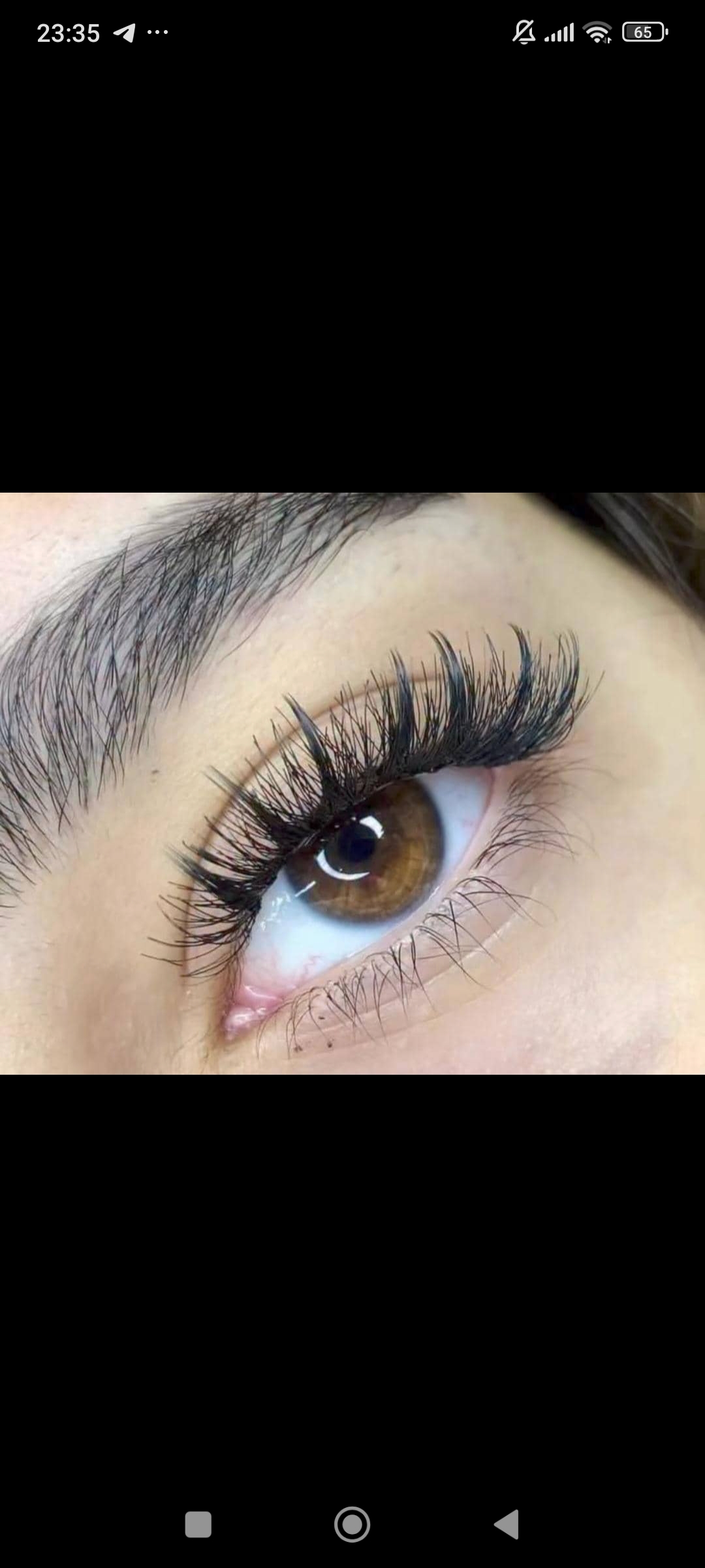 کاشت مژه پارسافر