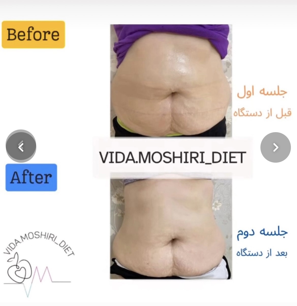 کلینیک لاغری ویدا مشیری