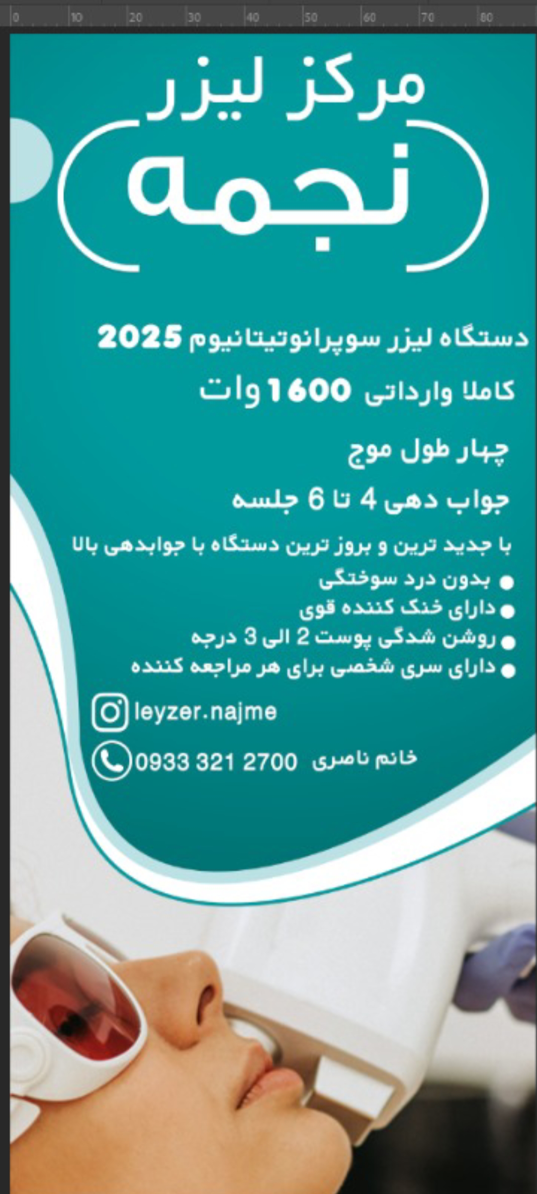 لیزر موهای زاید