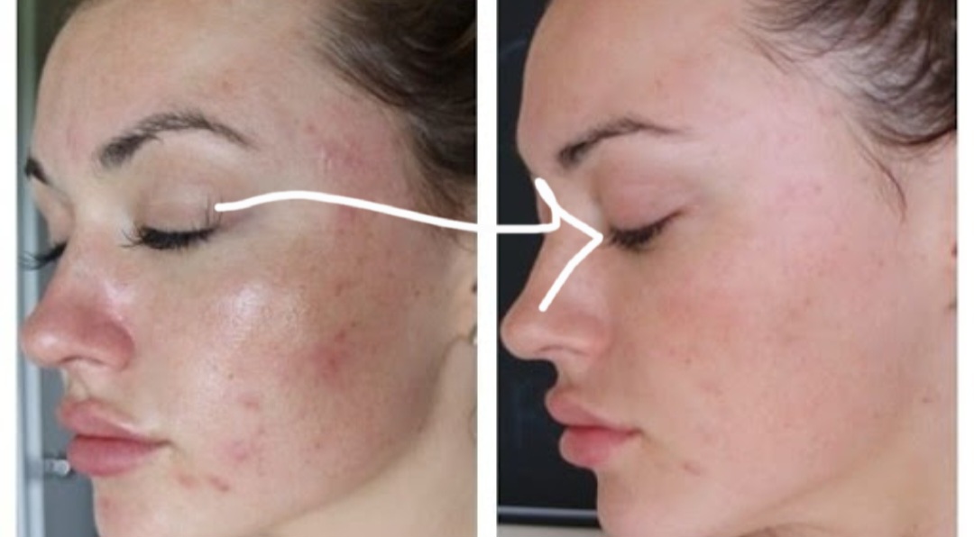 خدمات تخصصی پاکسازی پوست و فیشال نگاره