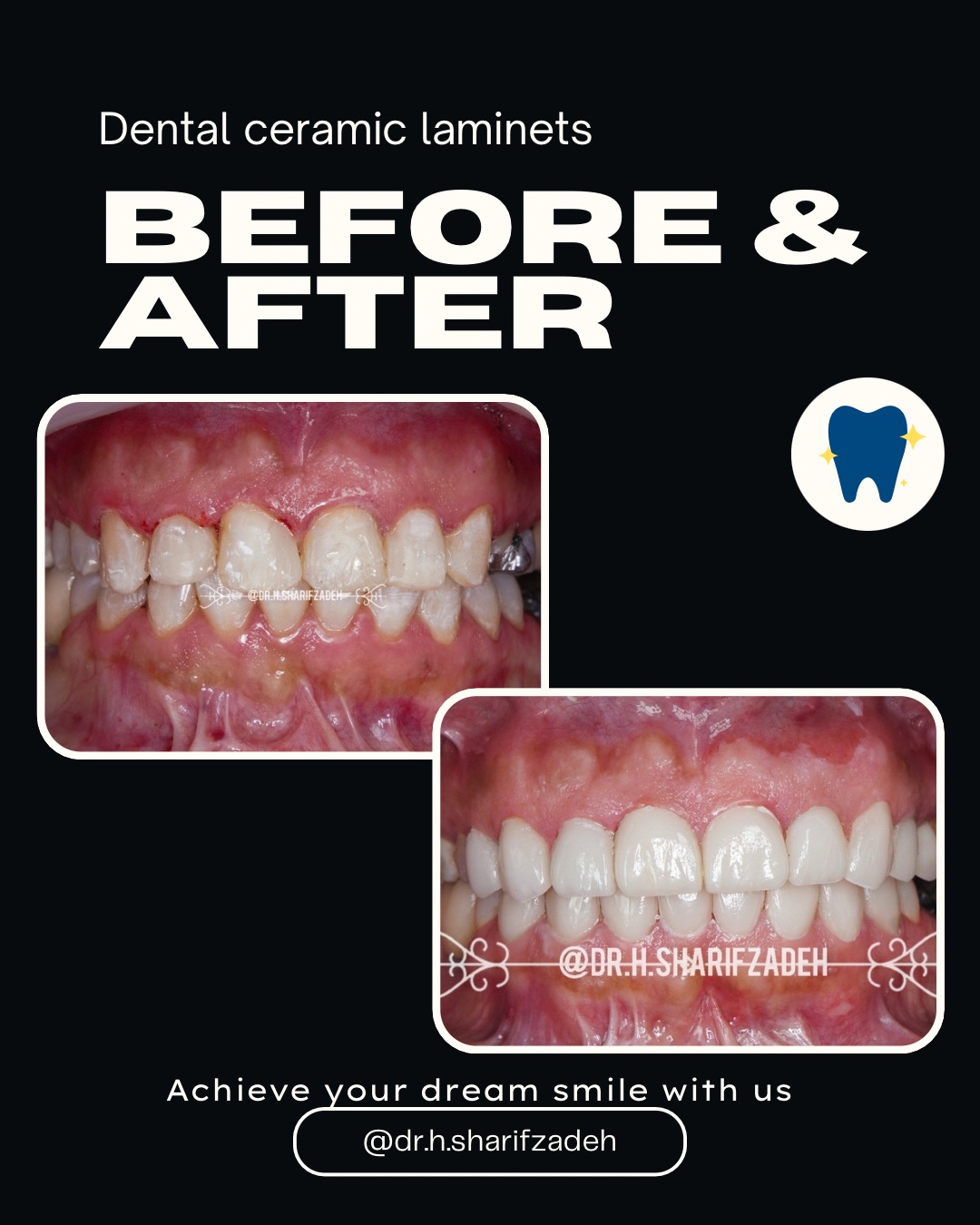 دندانپزشکی دکتر هدیه شریف زاده