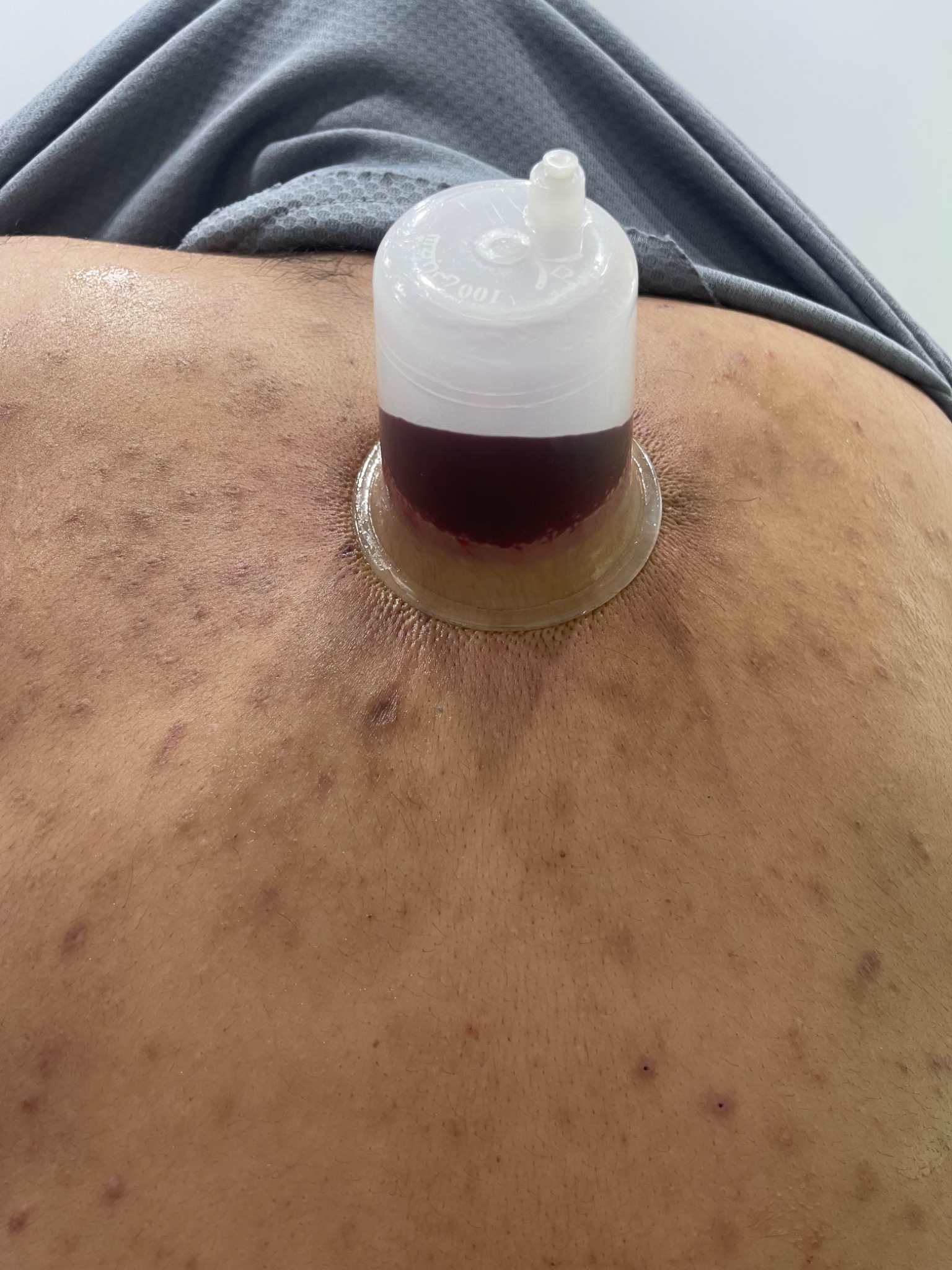 کلینیک لیزر و طب سنتی توک