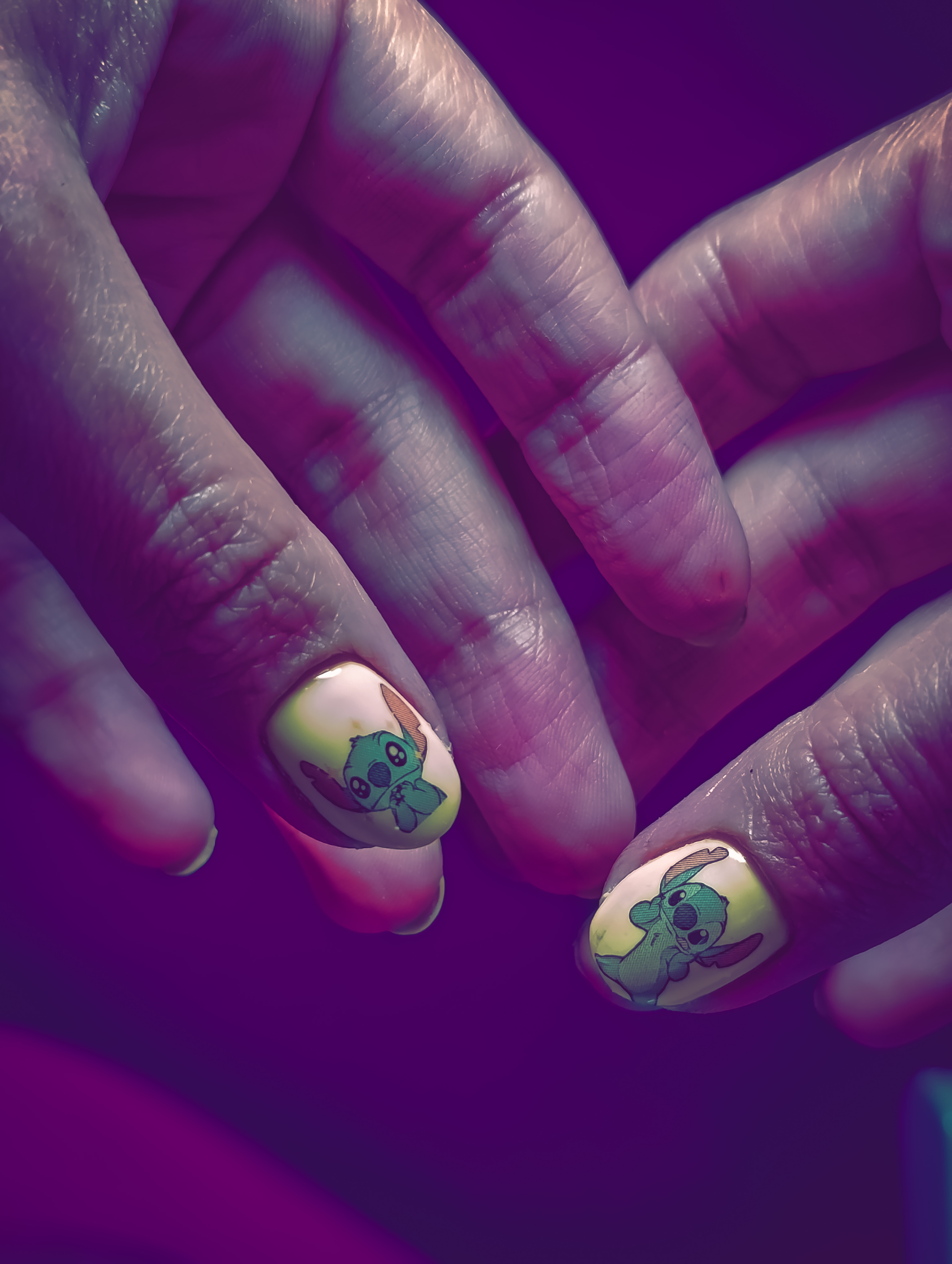 کاشت ناخن لوتوس