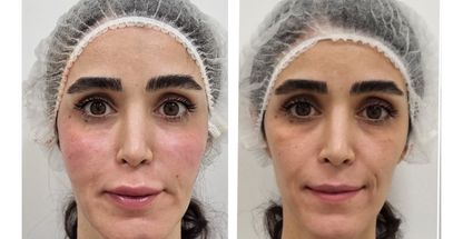 کلینیک تخصصی پوست مو زیبایی و لیزر هانا