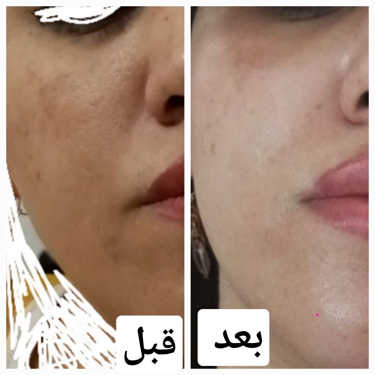خدمات فیشال پوست فاطمه سادات