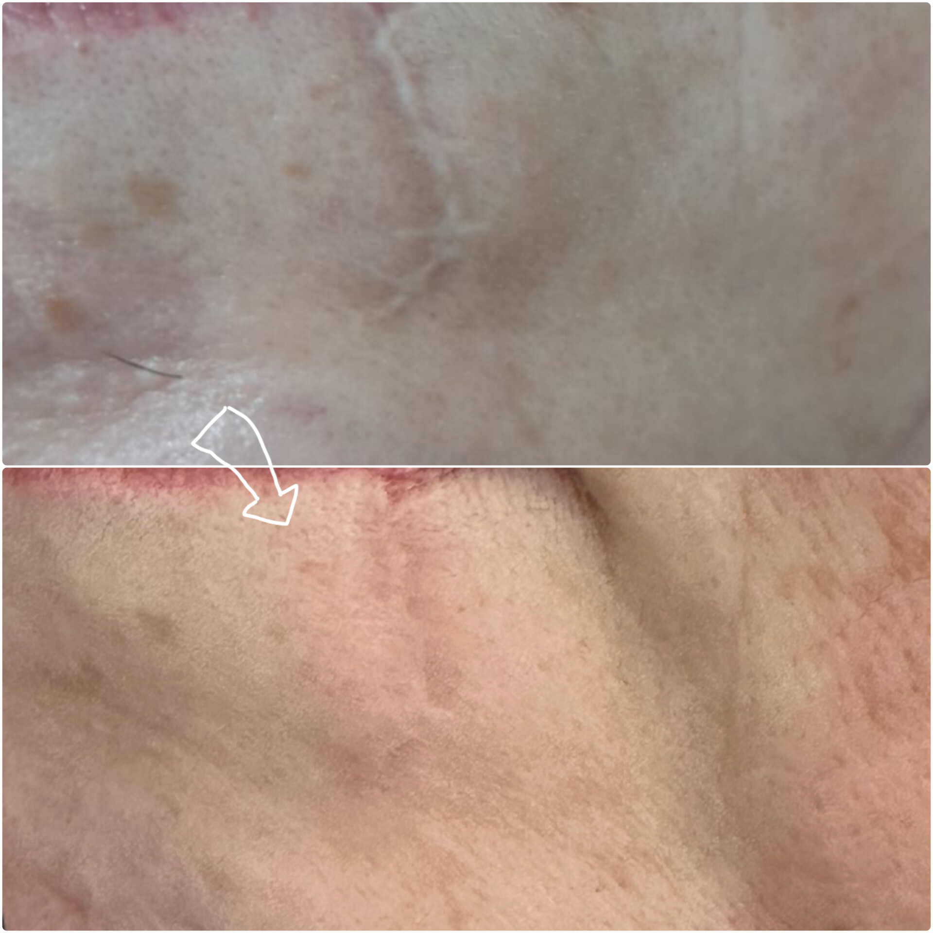 کلینیک هایفوتراپی جعفرزاده