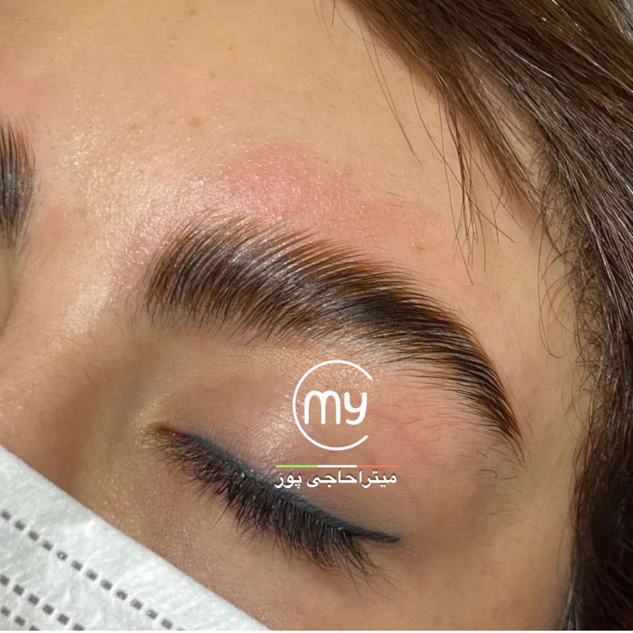 کاشت مژه و اکستنشن ابرو میترا