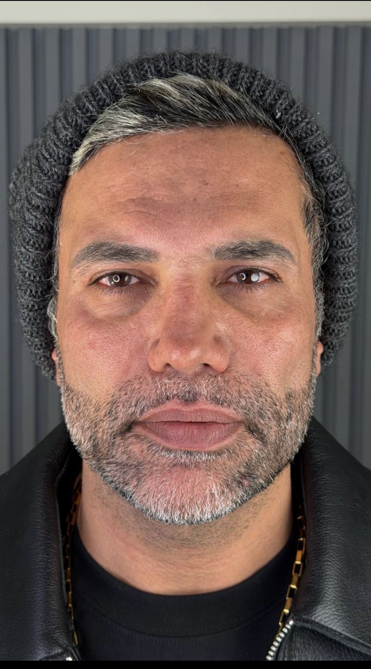 کلینیک زیبایی مهرزاد(شعبه تبریز)