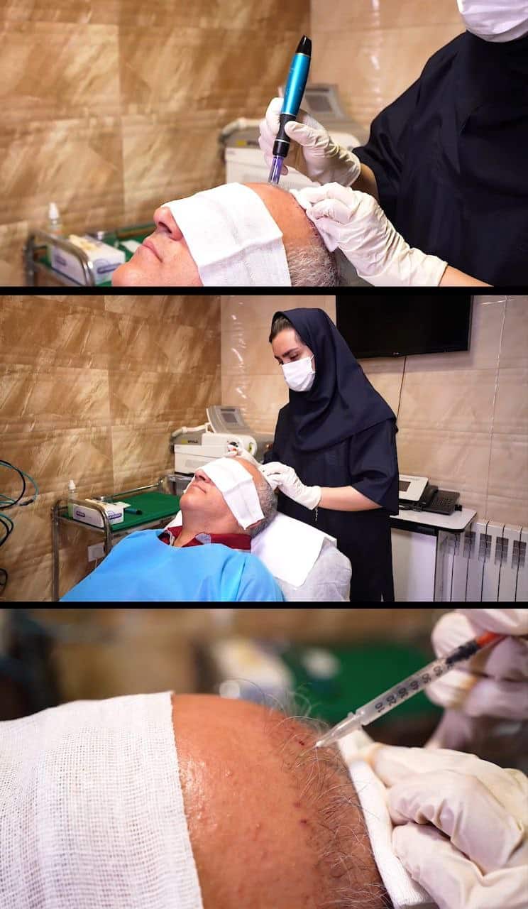 کلینیک کاشت مو و لاغری آفتاب