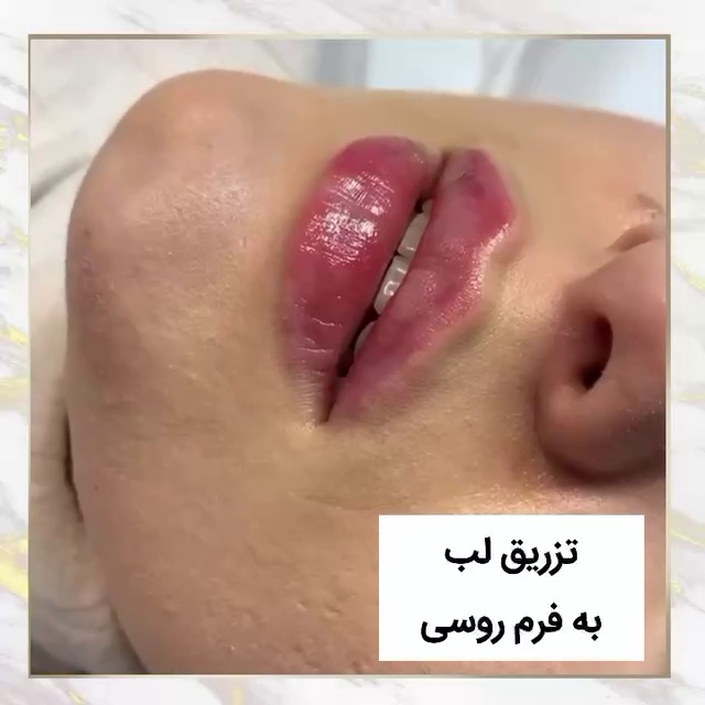 کلینیک زیبایی مهزیار