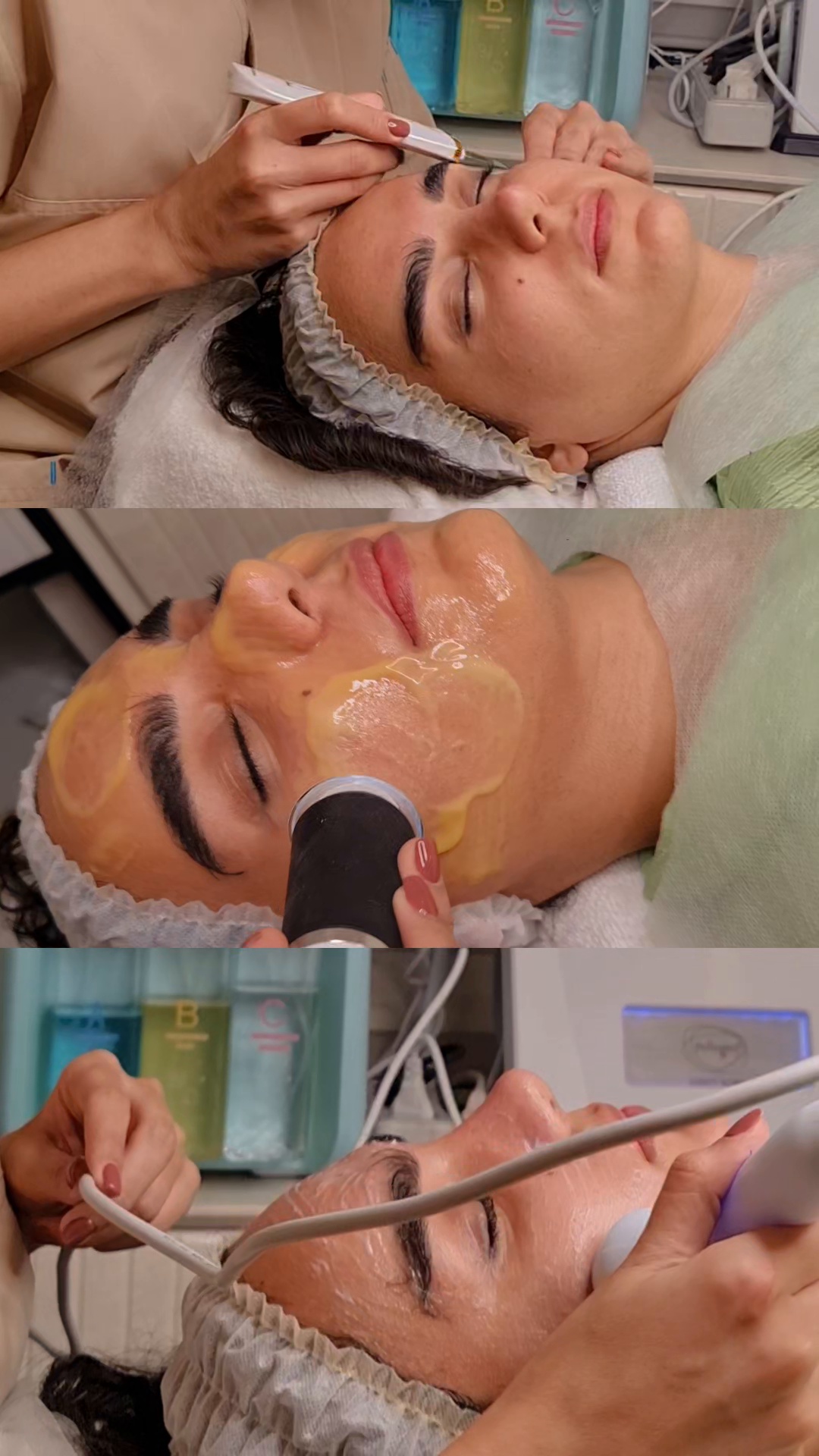 کلینیک لیزر الکس و زیبایی آنجل