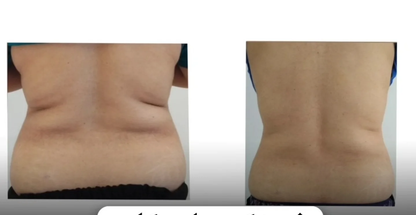 مرکز لاغری رادیکال