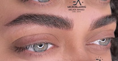 میکروبلیدینگ رشت ملیکا مینایی ریمو شیدلب