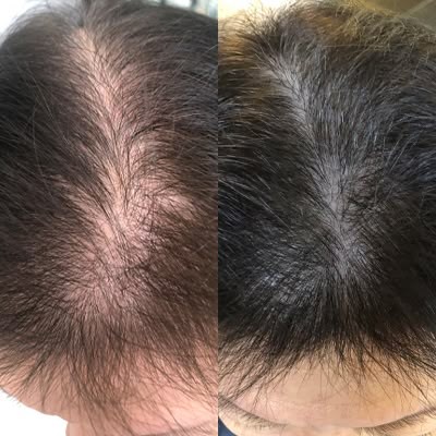 خدمات و درمان ریزش مو و رشد مو