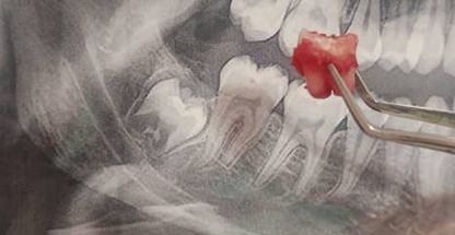 کلینیک دندانپزشکی دکتر امیر خداداد