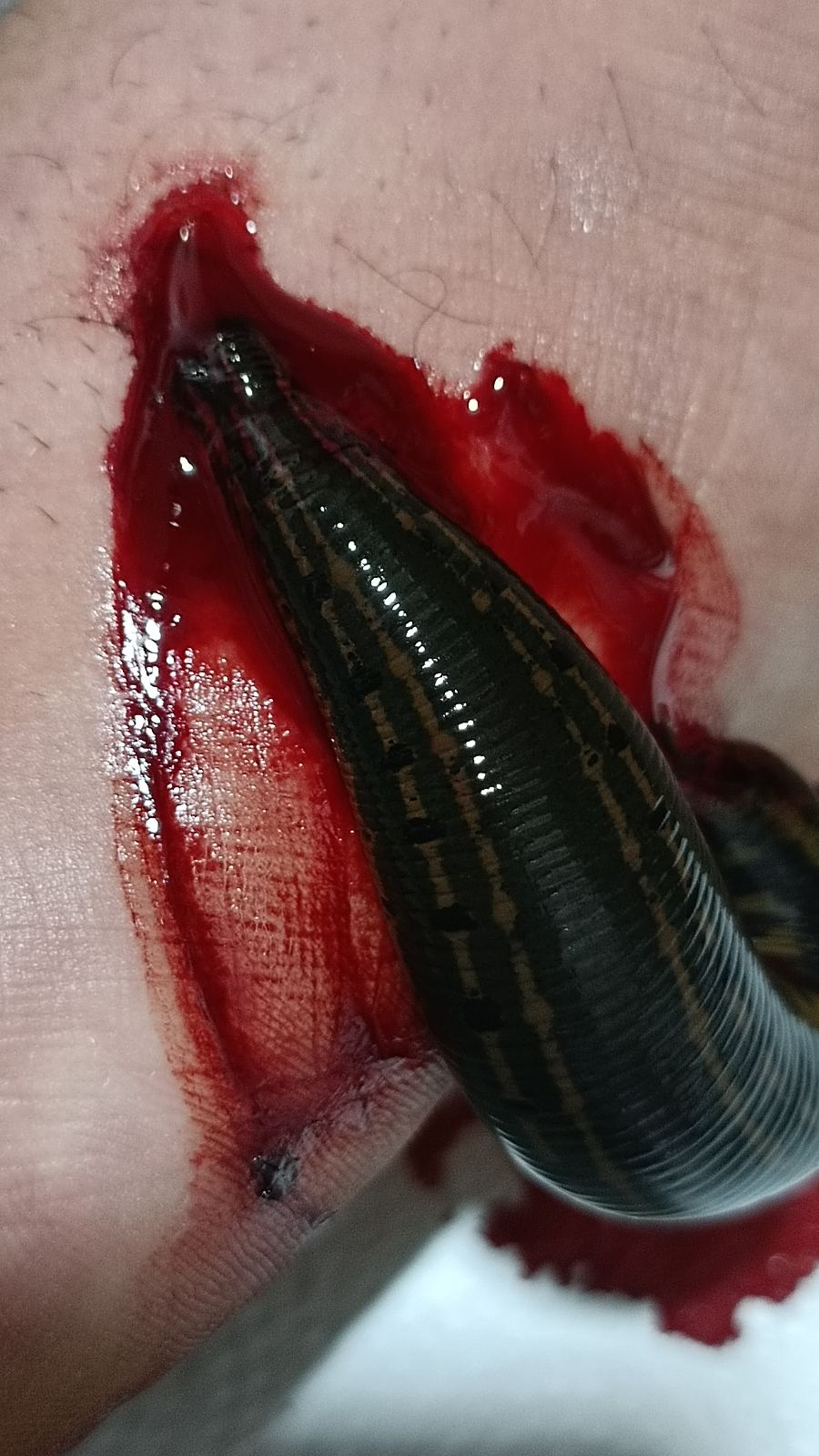طب سنتی لایف