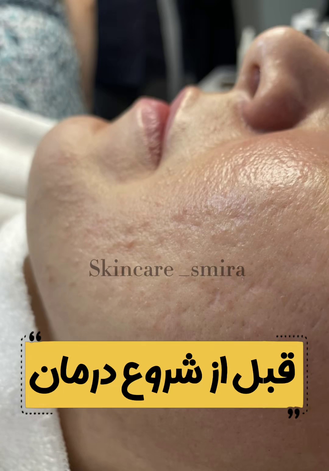 فیشال تخصصی و سالن پاکسازی پوست کامیابی