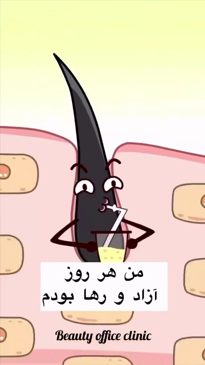 لیزر موهای زائد الهایی