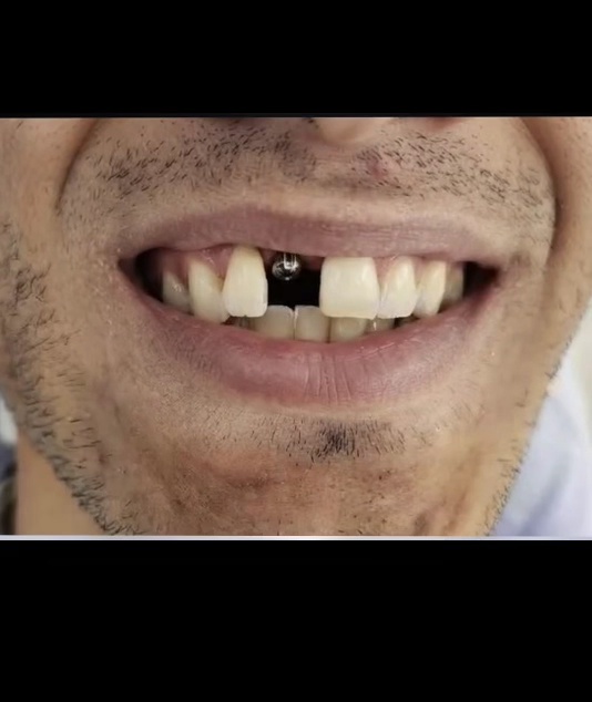 مطب دندانپزشکی آوینا