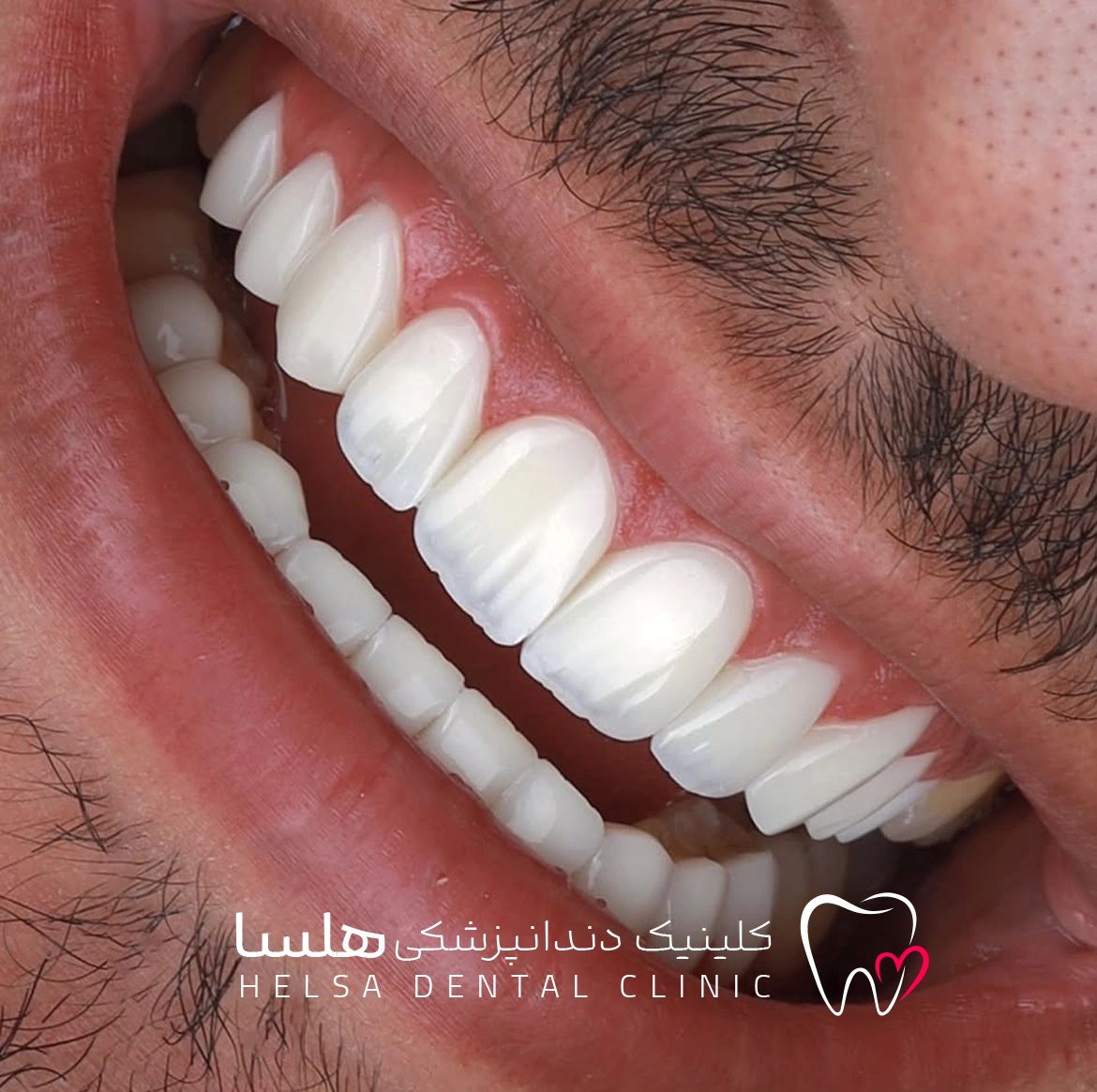 کلینیک دندانپزشکی هلسا(اقساط)