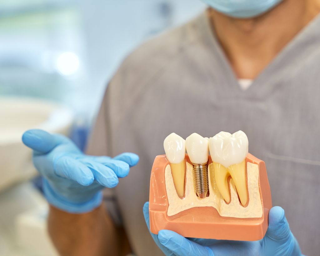 دندانسازی آریان