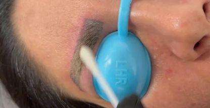 مرکز پوست مو لیزر ناقوس