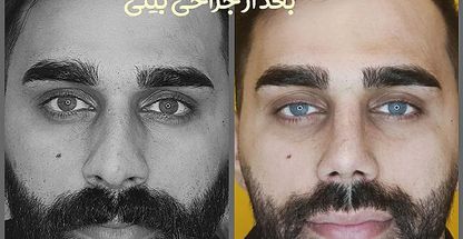 کلینیک زیبایی دکتر خلیل طلایی زاده