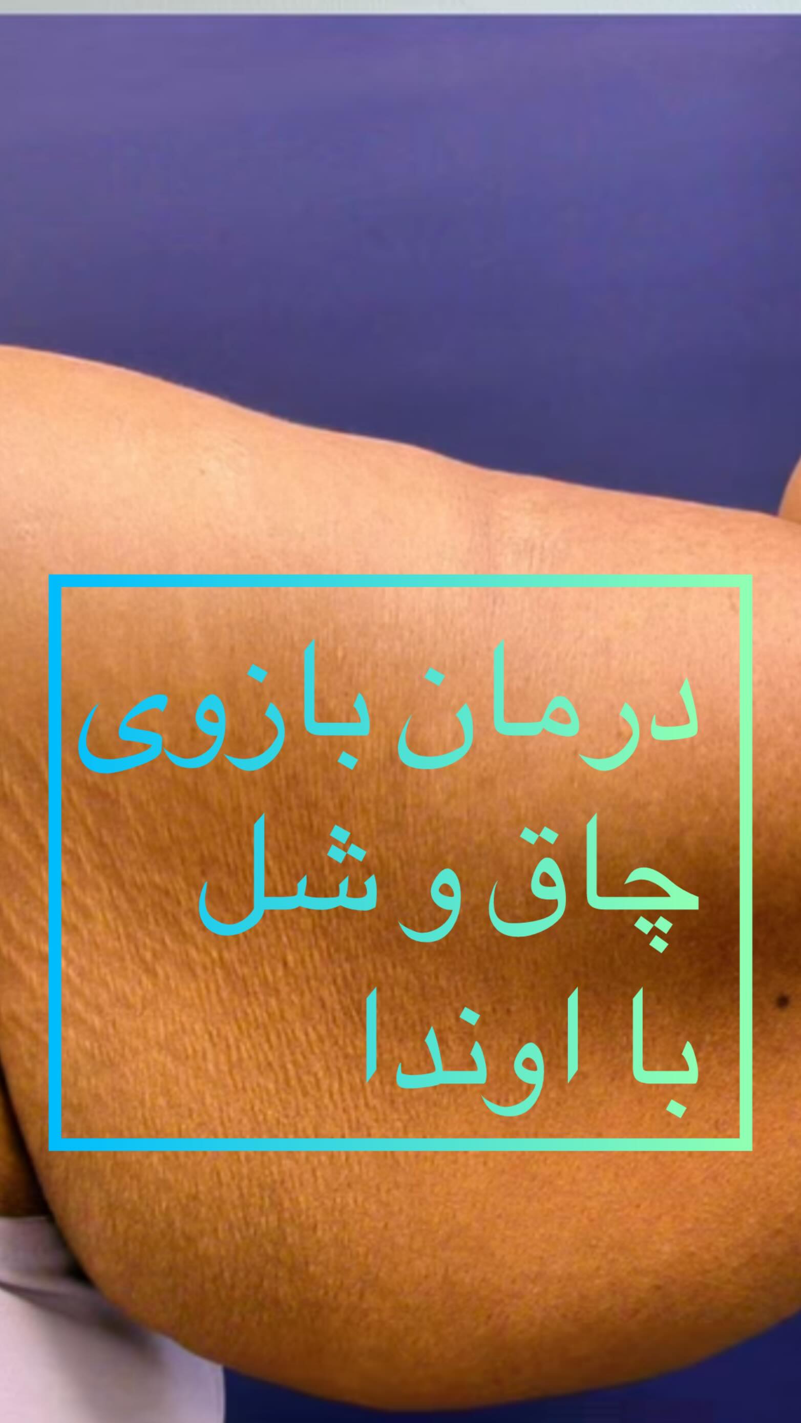 مرکز لاغری مدرن